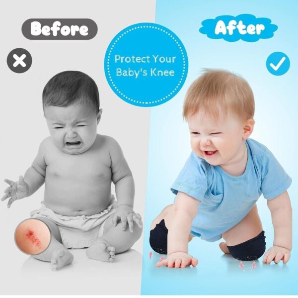 Baby Crawling Knee Pads – Soft & Anti-Slip Knee Protector for Infants and Toddlers - Image 4